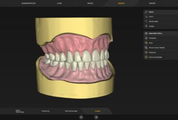 inLab CAD Software, removable partial dentures