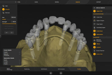 inLab CAD Software, Implantology module, screw retained bridge