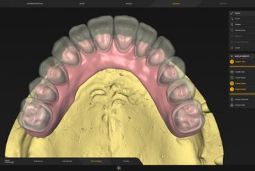 inLab CAD Software, Multi-layer-gingiva