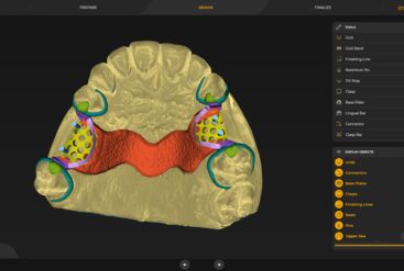 inLab CAD Software, bite splint