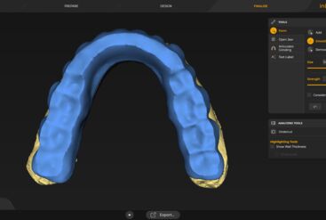 inLab CAD Software, individual attachment prosthesis