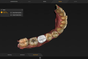 inLab CAD Software, surgical guide for integrated implantology