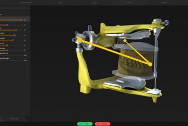 inLab CAD Software, Virtual articulator