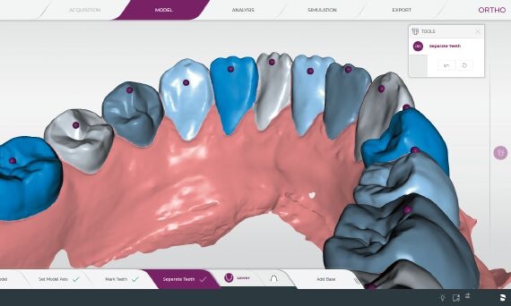 CEREC Ortho Model segmentation