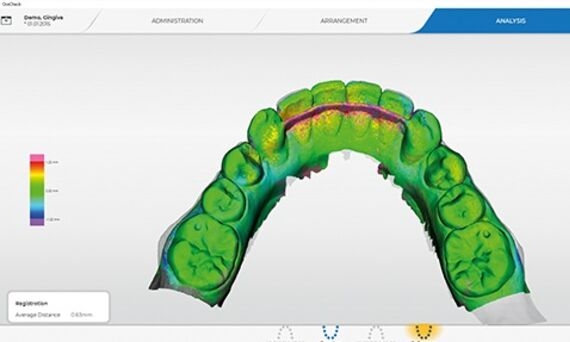 OraCheck arrange and analyze