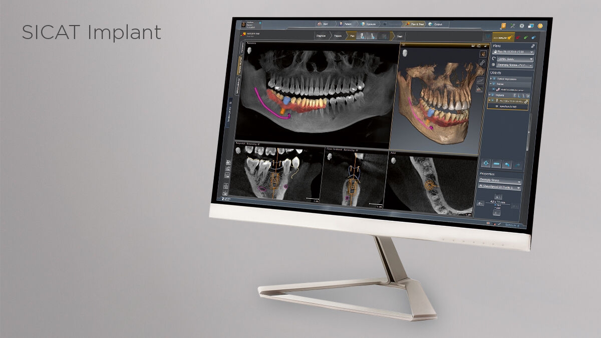 Sidexis 4 - Implant