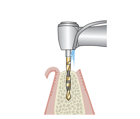 Pilot drilling