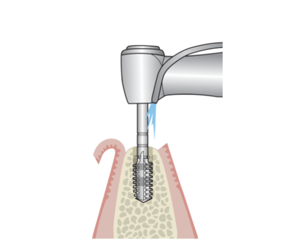 Operation of the tap motorized or manual