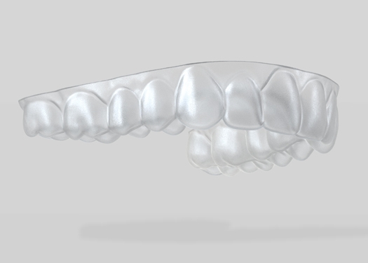 SureSmile Aligner