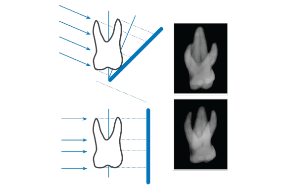 Tips bisecting technique steps