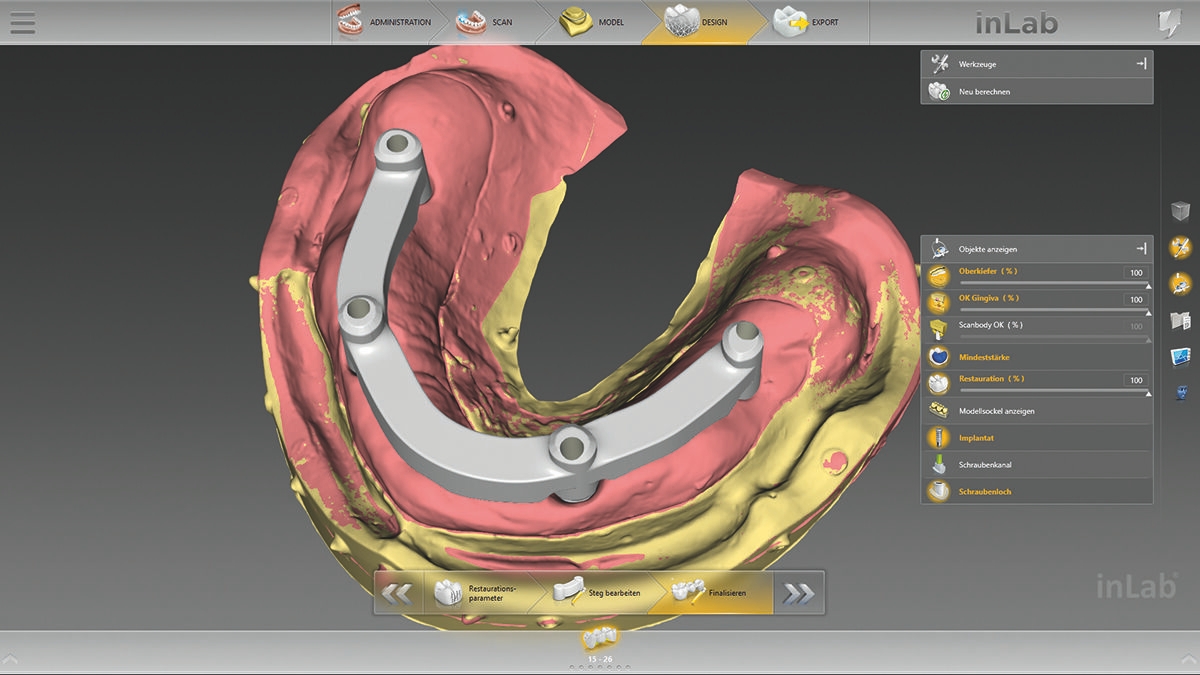 inLab CAD Software, standard bar
