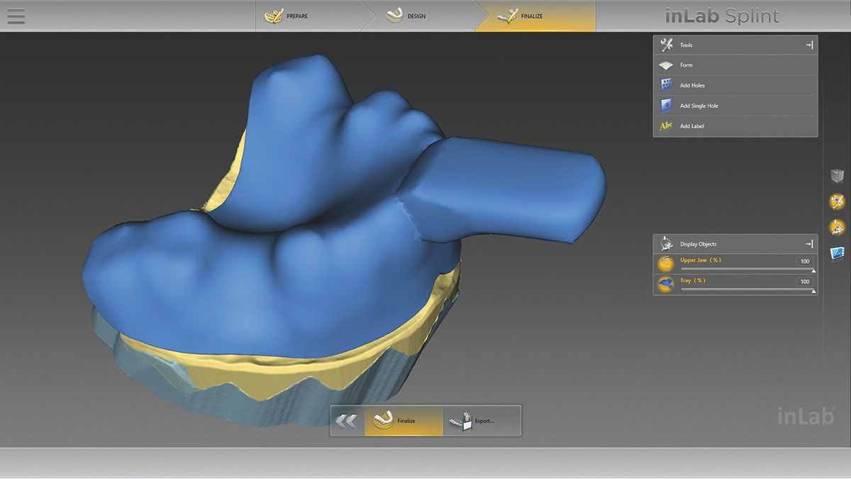 inLab CAD Software, individual impression tray