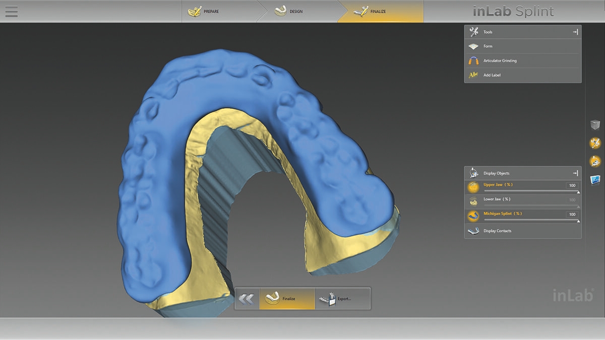 inLab CAD Software, bite splint