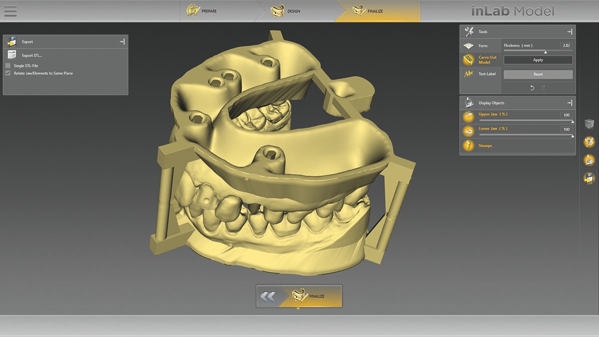 inLab CAD Software, Export of virtual data model