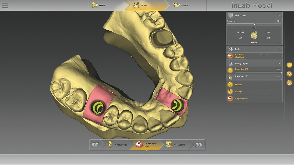 inLab CAD Software, Virtual data model with model analog