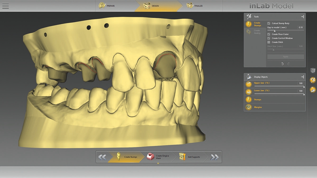 inLab CAD Software, Virtual data model
