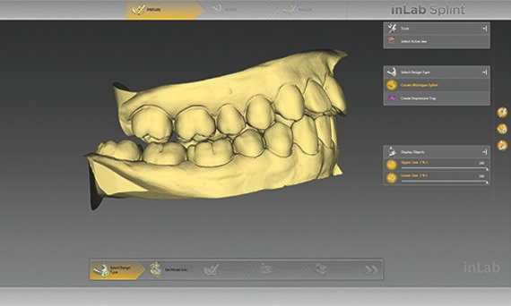 inLab CAD Software, cast