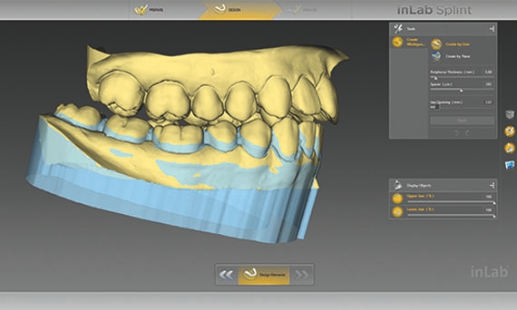 inLab CAD Software, undercuts are blocked