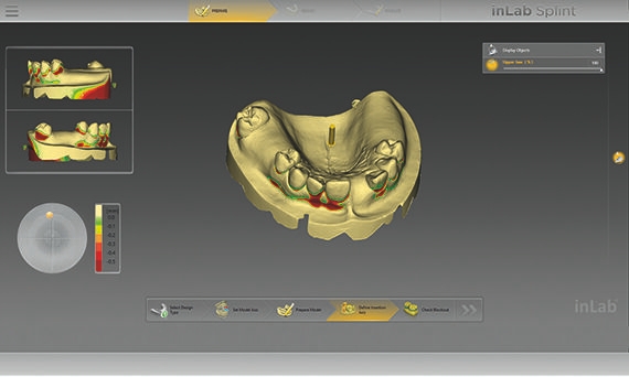 inLab CAD Software, contour of individual impression tray