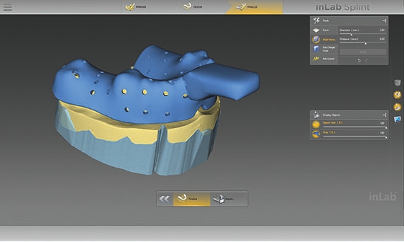inLab CAD Software, insertion of hole pattern