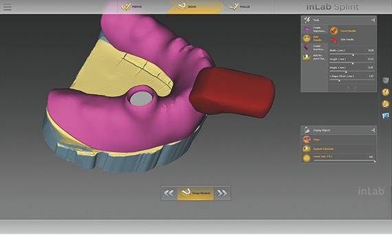 inLab CAD Software, setting of holes for impression posts