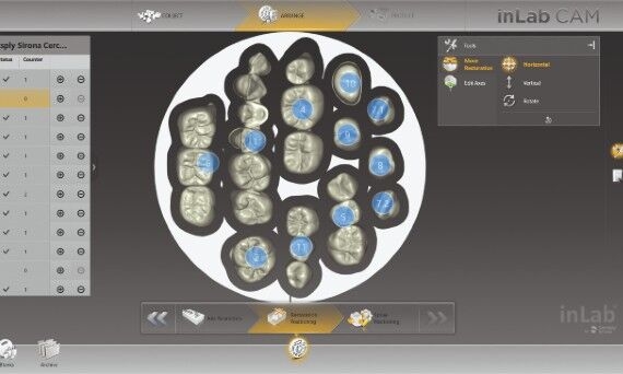 Smart positioning with inLab CAM Software