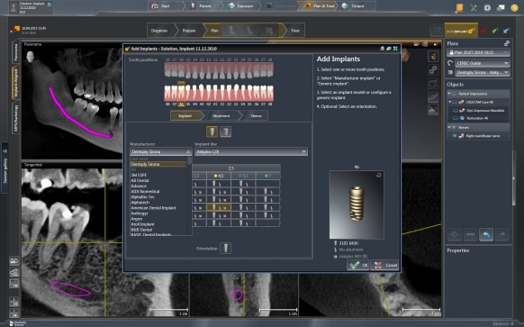 Selection Implant system in SICAT Implant