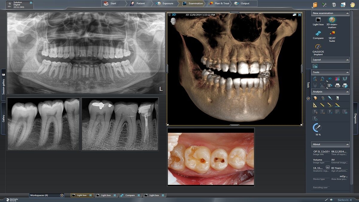 Xray data lightbox
