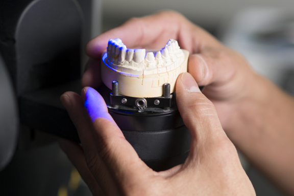 CAD CAM Scan