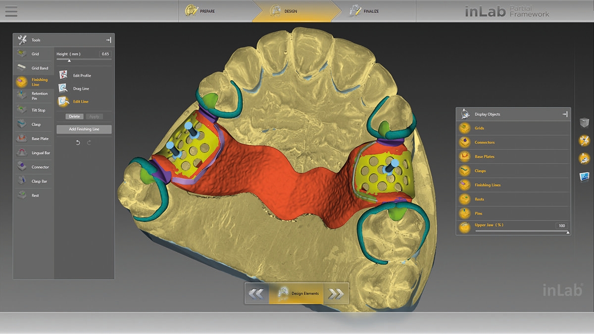 inLab CAD Software, removable partial dentures