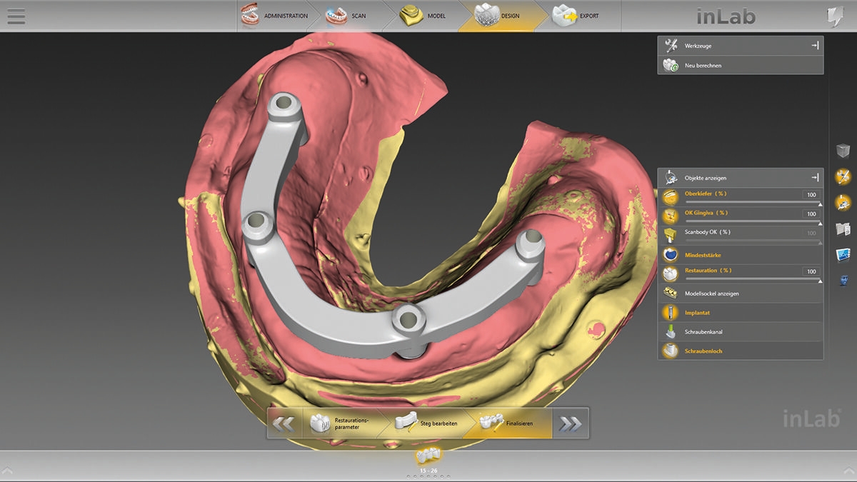 inLab CAD Software, standard bar