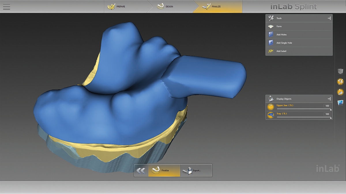 inLab CAD Software, individual impression tray