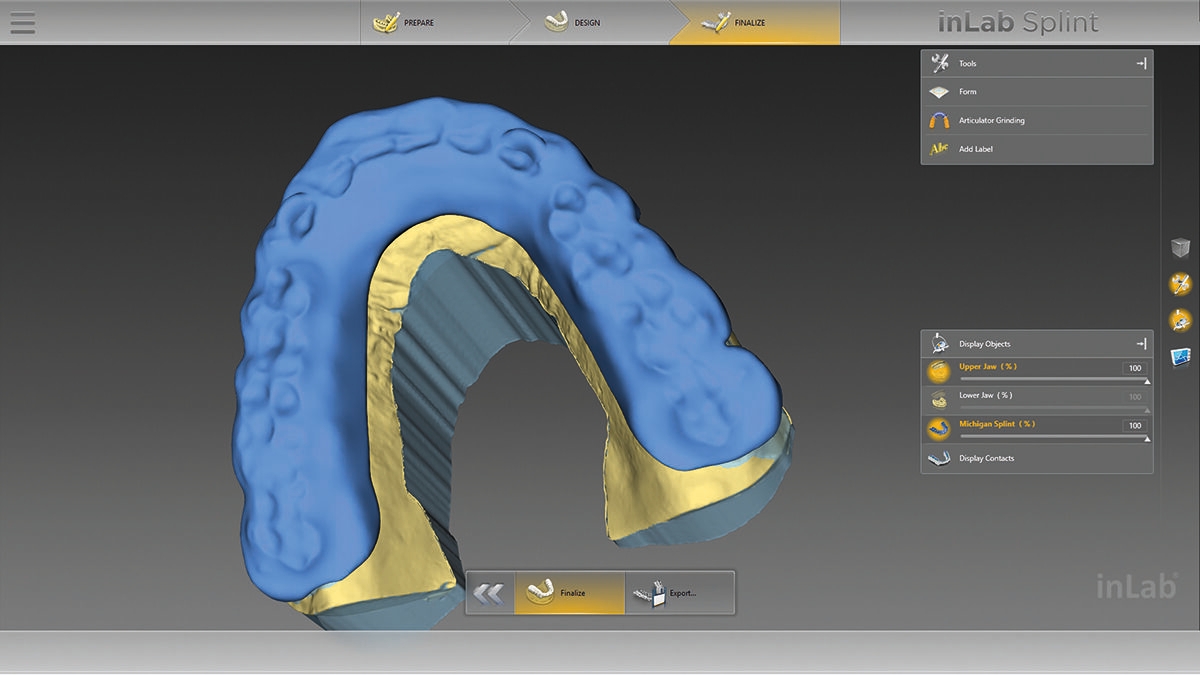 inLab CAD Software, bite splint