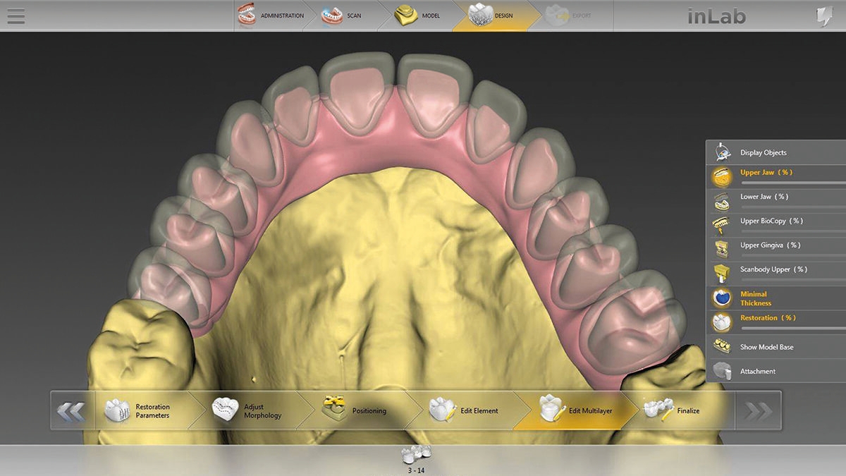 inLab CAD Software, Multi-layer-gingiva