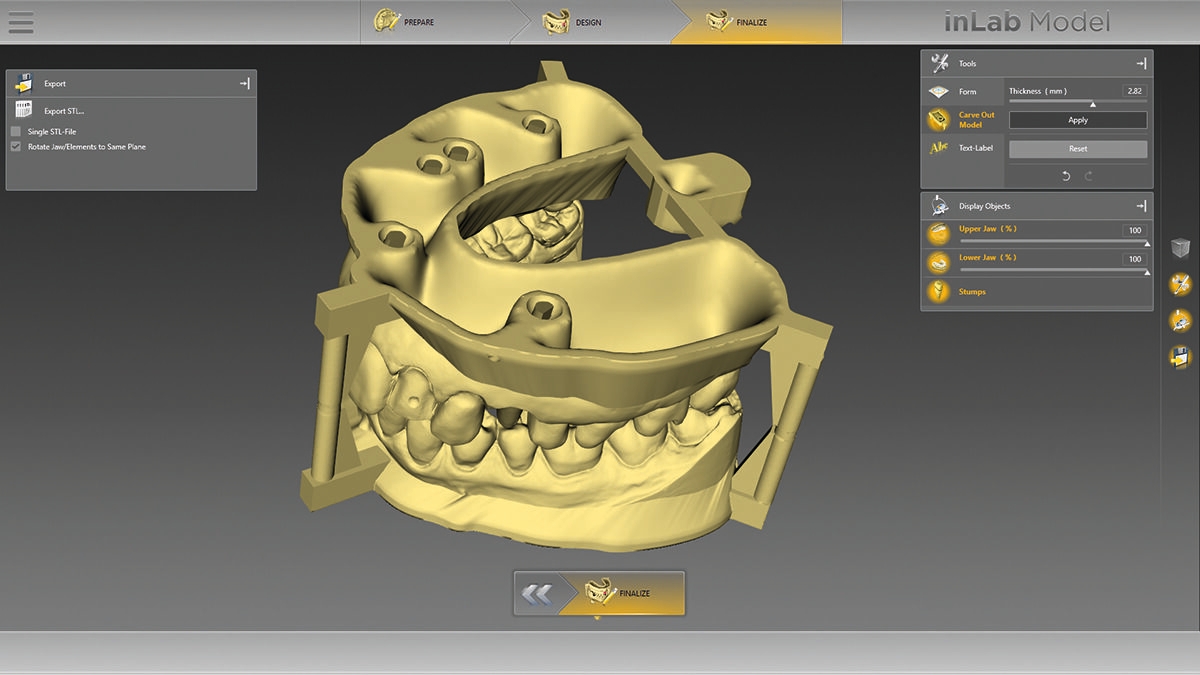 inLab CAD Software, Export of virtual data model