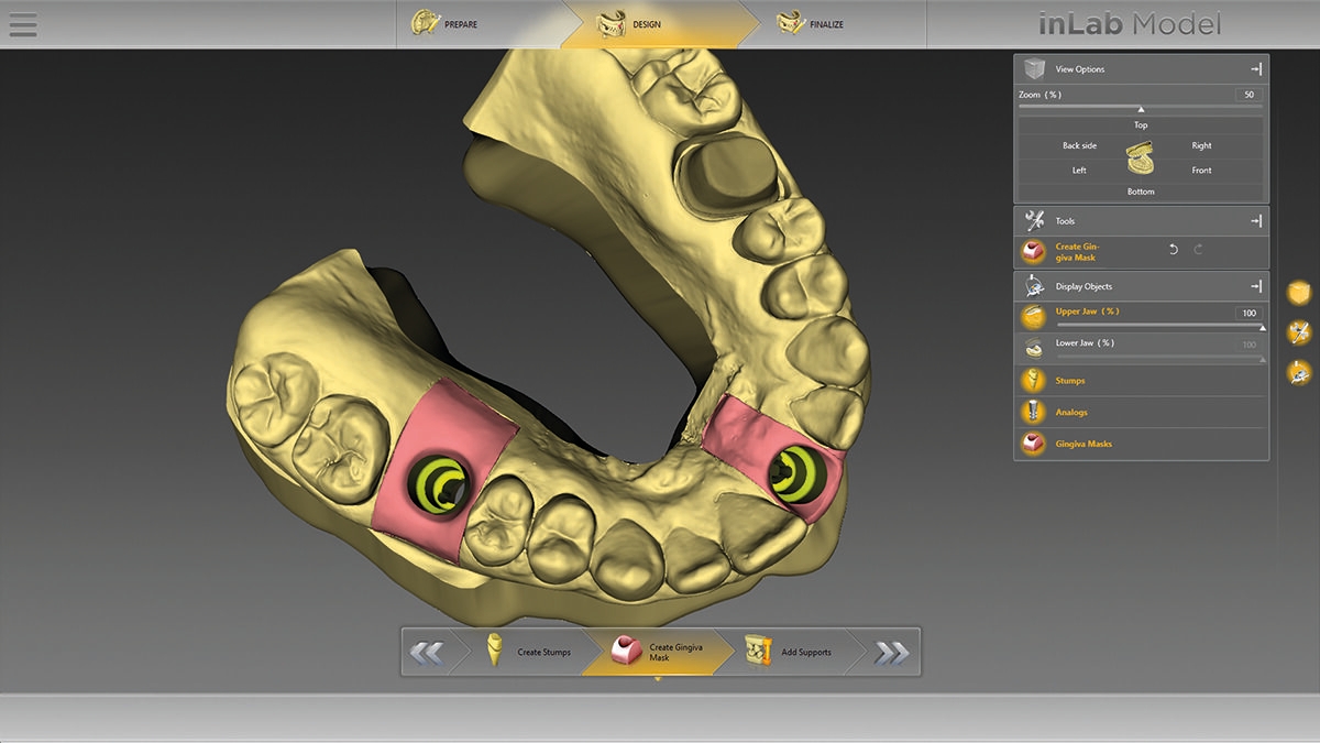 inLab CAD Software, Virtual data model with model analog