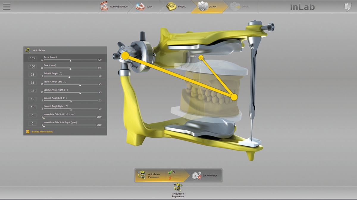 inLab CAD Software, Virtual articulator