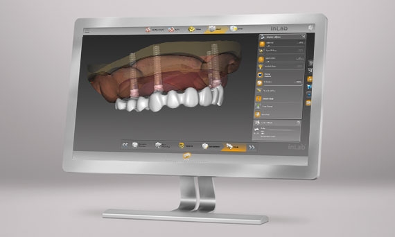inLab CAD Software, Implantology module