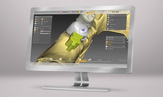 inLab CAD Software, Removables module