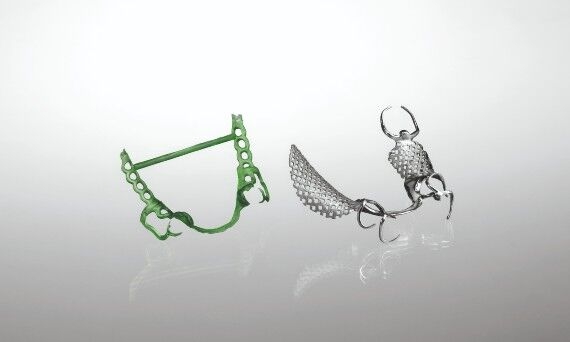 Cast metal framework