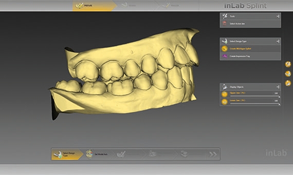 inLab CAD Software, cast
