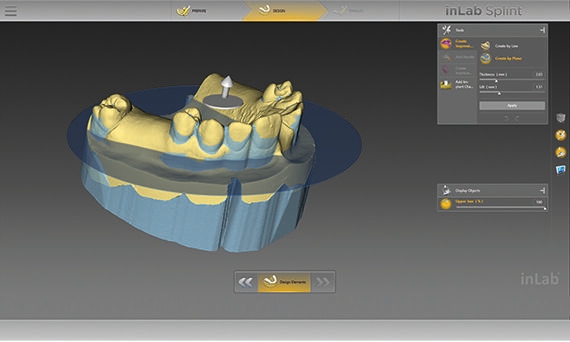 inLab CAD Software, undercuts of a model are visualized
