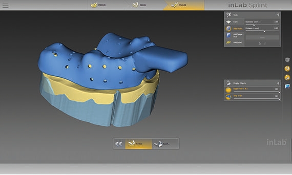 inLab CAD Software, insertion of hole pattern