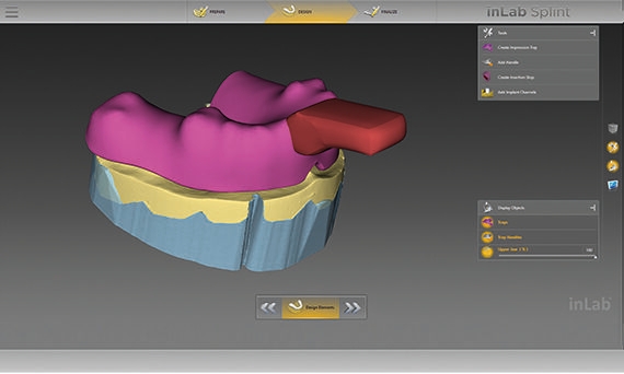 inLab CAD Software, options for handling an individual impression tray