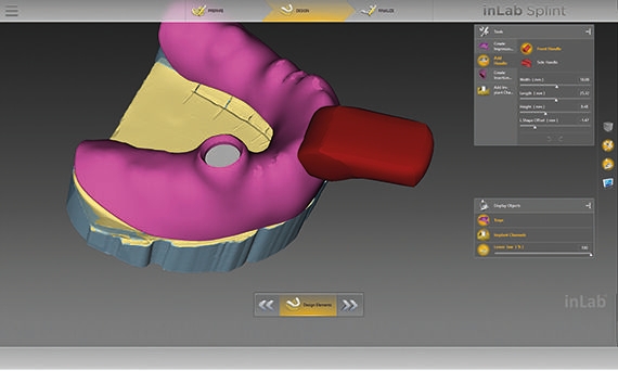 inLab CAD Software, setting of holes for impression posts
