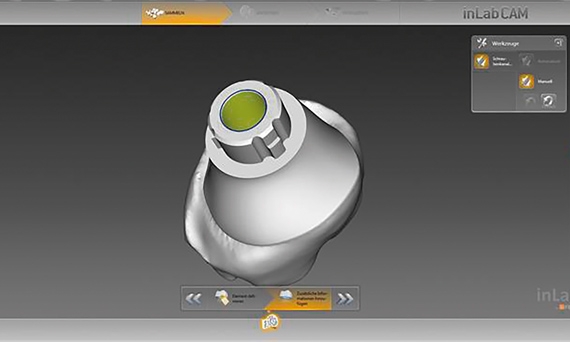 Import of restoration data from 3Shape, exocad