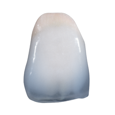 Incisor Image Kiss veneering ceramics for metal frameworks