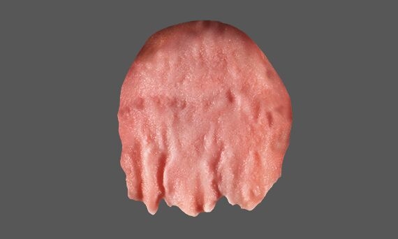 Chroma Powder Kiss ceramic veneering concept for metal frameworks
