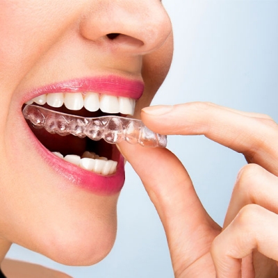 Woman holding a SureSmile Aligner from Dentsply Sirona
