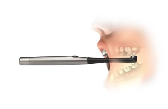 Use of SmartLIte Pro for light curing